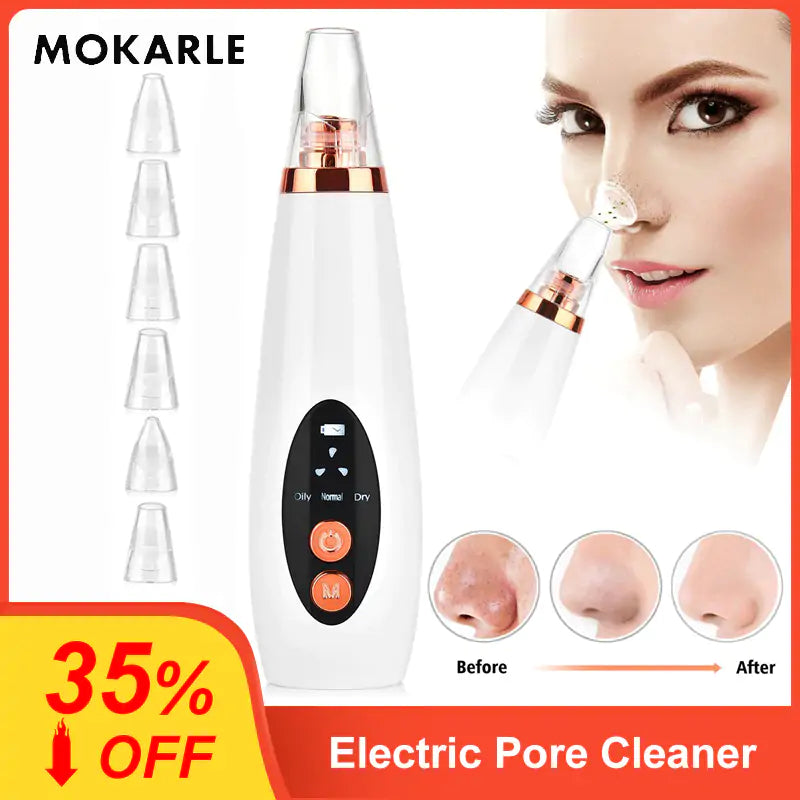 Electric Blackhead Removing Device